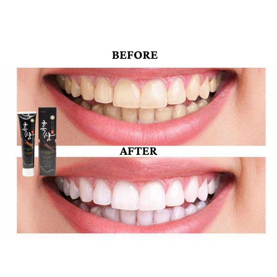 KOREAN GINSENG TOOTHPASTE KEM ĐÁNH RĂNG NHÂN SÂM